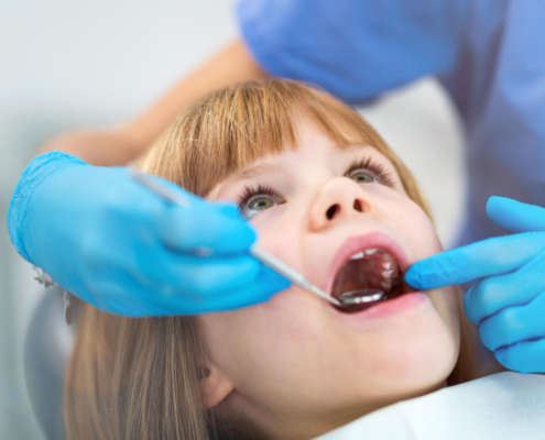 Małe dziecko leży z otwartą buzią na fotelu dentystycznym, a dentystka ogląda jego jamę ustną i mleczaki, wyjaśniając, czy leczyć zęby mleczne.